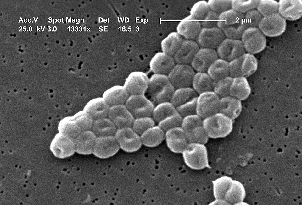Scanning electron micrograph of multidrug-resistant Acinetobacter baumannii bacteria