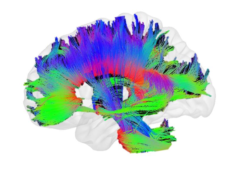 DTI-derived tractography of human brain white matter pathways — a connectomics visualization showing neural connections color-coded by direction and density