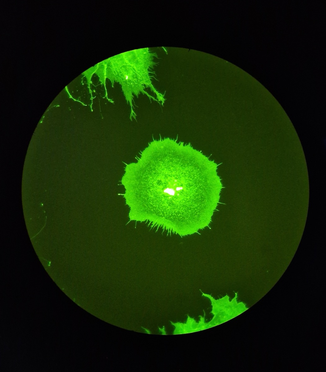 Fluorescence microscopy image of cells stained with a fluorescent dye that reveals the actin cytoskeleton — the kind of image Cell Painting captures