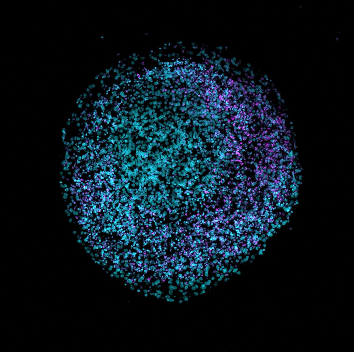 DAPI(청록색)와 VIPR2(마젠타색)로 염색한 인간 뇌 오가노이드의 단면 형광 현미경 이미지
